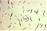 Clostridium perfringens 병원체 이미지입니다. 