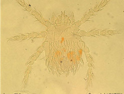 광학현미경으로 본 대잎털진드기