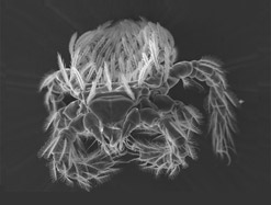 전자현미경으로 본 대잎털진드기