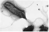 Helicobacter pylori 병원체 이미지입니다. 