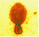 Hendra virus (Equine morbillivirus) 병원체 이미지입니다.