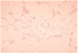 Actinobacillus spp. 병원체 이미지입니다.