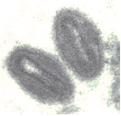 Monkeypox virus 병원체 이미지입니다.