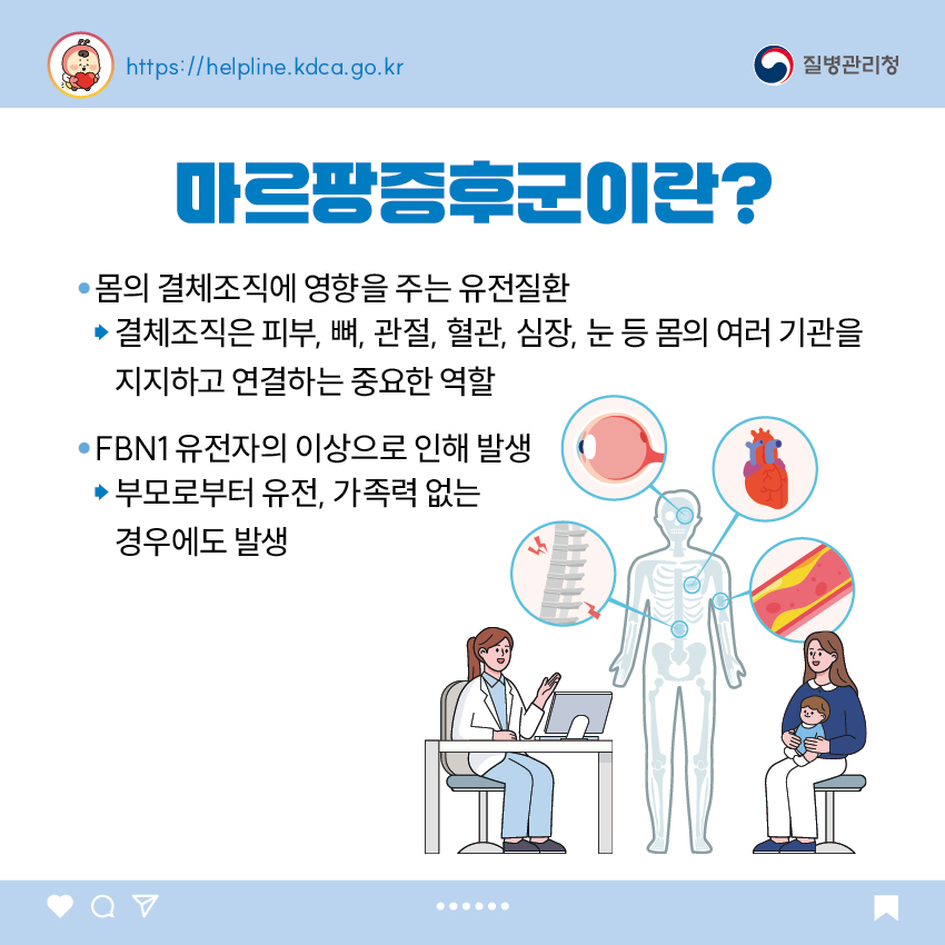 마르팡증후군이란? - 몸의 결체조직에 영향을 주는 유전질환 -> 결체조직은 피부, 뼈, 관절, 혈관, 심장, 눈 등 몸의 여러 기관을 지지하고 연결하는 중요한 역할 - FBN1 유전자의 이상으로 인해 발생 -> 부모로부터 유전, 가족력 없는 경우에도 발생