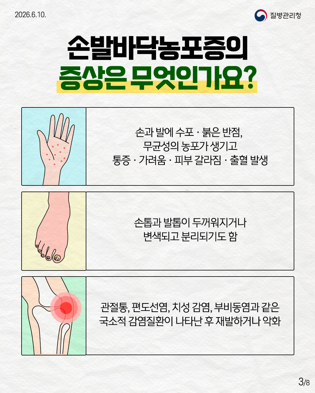 3페이지 손발바닥농포증의 증상은 무엇인가요? 손과 발에 수포 · 붉은 반점, 무균성의 농포가 생기고 통증 · 가려움 · 피부 갈라짐 · 출혈 발생 손톱과 발톱이 두꺼워지거나 변색되고 분리되기도 함 관절통, 편도선염, 치성 감염, 부비동염과 같은 국소적 감염질환이 나타난 후 재발하거나 악화