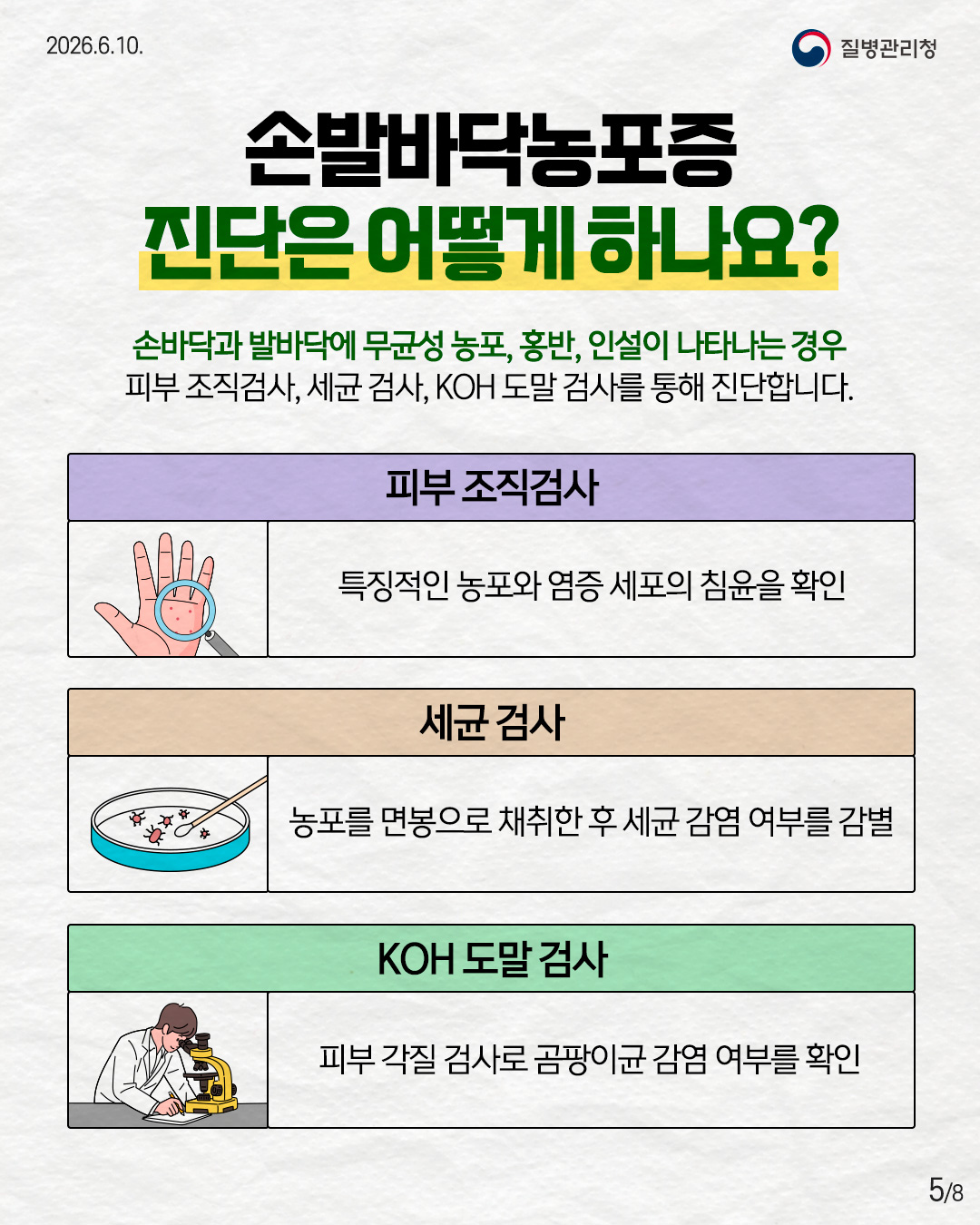 5페이지 손발바닥농포증 진단은 어떻게 하나요? 손바닥과 발바닥에 무균성 농포, 홍반, 인설이 나타나는 경우 피부 조직검사, 세균 검사, KOH 도말 검사를 통해 진단합니다. 피부 조직검사 특징적인 농포와 염증 세포의 침윤을 확인 세균 검사 포를 면봉으로 채취한 후 세균 감염 여부를 감별 KOH 도말 검사 피부 각질 검사로 곰팡이균 감염 여부를 확인