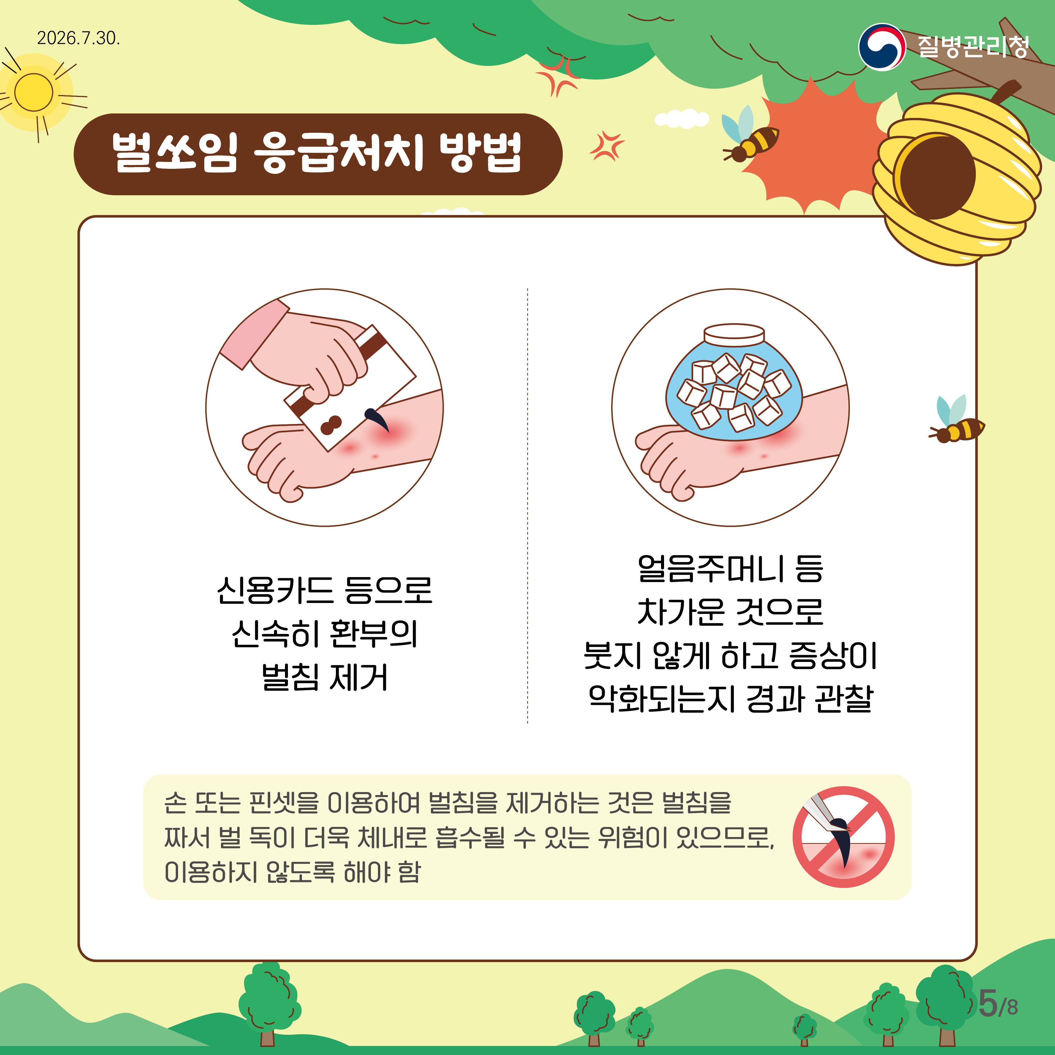 벌쏘임 응급처치 방법  신용카드 등으로 환부의 벌침 제거 얼음주머니 등 차가운 것으로 붓지 않게 하고 증상이 악화되는지 경과 관찰  손 또는 핀셋을 이용하여 벌침을 제거하는 것은 벌침을 짜서 벌 독이 더욱 체내로 흡수될 수 있는 위험이 있으므로, 이용하지 않도록 해야함 