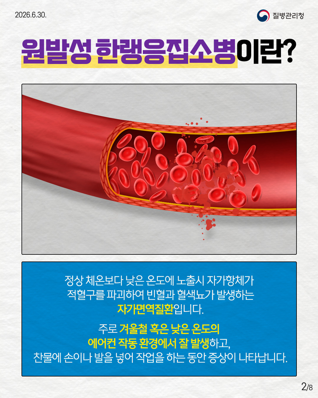 260630-희귀질환_원발성-한랭응집소병2.jpg 첨부 이미지