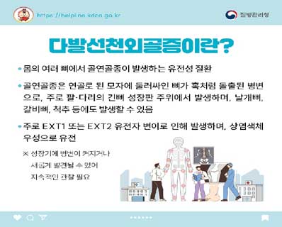 다발선천외골증이란? 표지 이미지