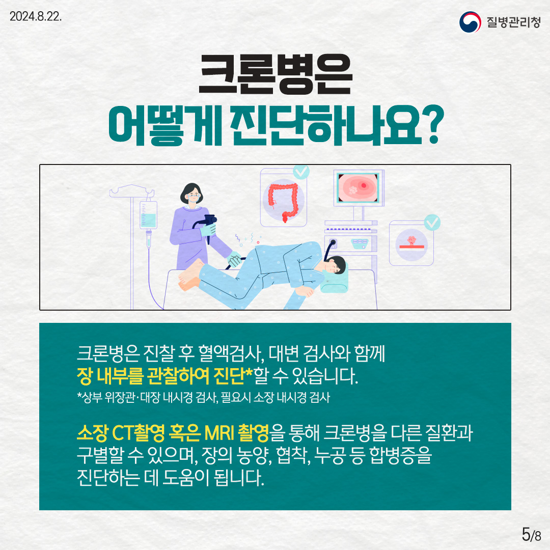 크론병은 진찰 후 혈액검사, 대변 검사와 함께 장 내부를 관찰하여 진단*할 수 있습니다. *상부 위장관·대장 내시경 검사, 필요시 소장 내시경 검사 소장 CT촬영 혹은 MRI 촬영을 통해 크론병을 다른 질환과 구별할 수 있으며, 장의 농양, 협착, 누공 등 합병증을 진단하는 데 도움이 됩니다.