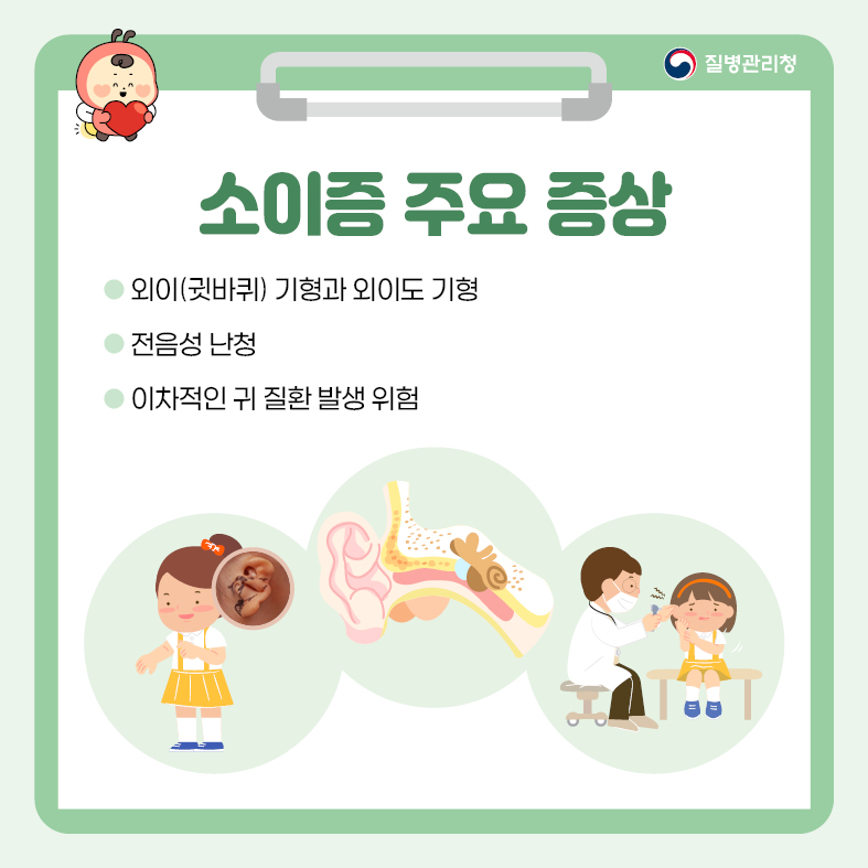 소이증 주요 증상 - 외이(귓바퀴) 기형과 외이도 기형 - 전음성 난청 - 이차적인 귀 질환 발생 위험