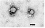 Lymphocytic choriomeningitis virus 병원체 이미지입니다. 