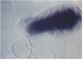 Bartonella vinsonii 병원체 이미지입니다.