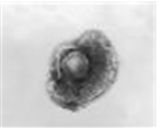 Varicella zoster virus 병원체 이미지입니다. 
