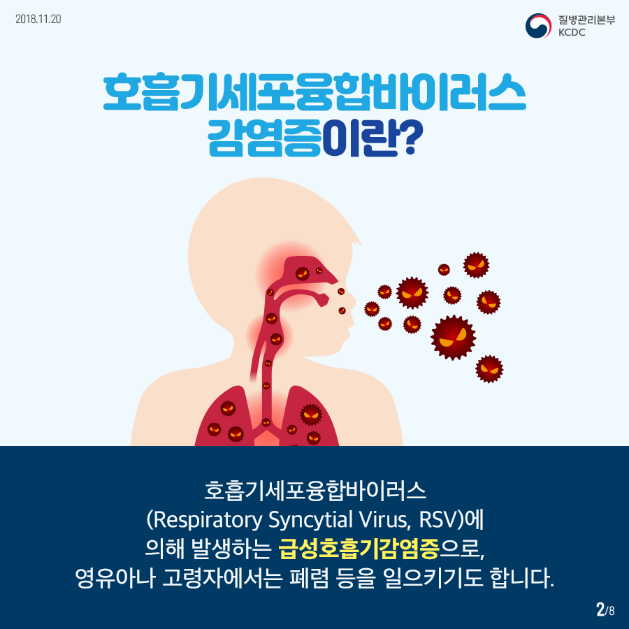 2018년 11월 20일 질병관리본부 KCDC 호흡기세포융합바이러스 감염증이란? 호흡기세포융합바이러스(Respiratory Synctial Virus, RSY)에 의해 발생하는 급성호흡기감염증으로, 영유아나 고령자에서는 폐렴 등을 일으키기도 합니다. 8페이지 중 2페이지