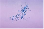 Blastomyces dermatitidis 병원체 이미지입니다. 