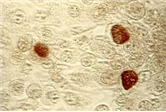 Chlamydia trachomatis 병원체 이미지입니다. 