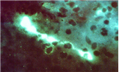 Chlamydophila psittaci 병원체 이미지입니다.