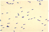 Clostridium botulinum 병원체 이미지입니다.