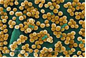Staphylococcus aureus 병원체이미지입니다. 