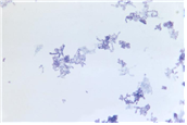 Corynebacterium spp bacteria 병원체 이미지 입니다.