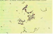 Streptobacillus moniliformis 병원체 이미지입니다. 