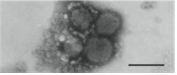 Crimean­Congo hemorrhagic fever virus 병원체 이미지입니다. 