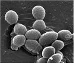Enterococcus faecalis, E. faecium 병원체 이미지입니다. 