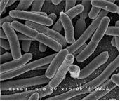 Escherichia coli 병원체 이미지입니다. 