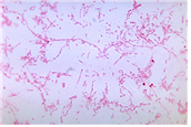 Fusobacterium necrophorum 병원체 이미지입니다.