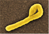Ebolavirus 병원체이미지입니다. 