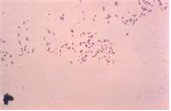 Rhodococcus equi 병원체이미지입니다.
