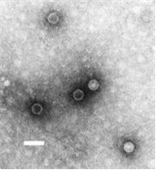 Poliovirus 병원체 이미지입니다.