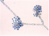 Exophiala(Wangiella) dermatitidis 병원체 이미지입니다. 