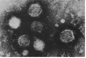 Powassan virus 병원체 이미지입니다. 