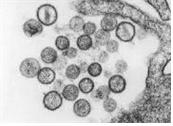 Hantaan virus (Sin Nombre virus) 병원체 이미지입니다.