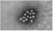 Hepatitis A virus (Hepatovirus A)