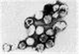 Rubella virus 병원체 이미지입니다. 