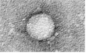 Hepatitis C virus 병원체 이미지입니다. 