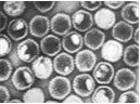 Herpes simplex virus(HSV) 1 and 2 병원체 이미지입니다. 