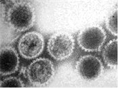 Herpesvirus simiae 병원체 이미지입니다. 