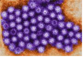 Norovirus(Norwalk virus) 병원체 이미지입니다.