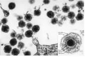 Human herpesvirus type 6, 7 병원체 이미지입니다. 