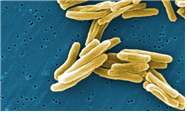 M. tuberculosis 병원체 이미지입니다. 