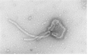 Human respiratory syncytial virus 병원체 이미지입니다. 