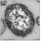Measles virus 병원체이미지입니다.