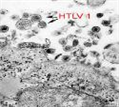 Human T cell lymphotropic virus (HTLV) type 1 병원체 이미지입니다. 