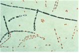 Bacillus anthracis 병원체 이미지입니다.