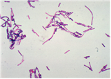 Bacillus cereus 병원체 이미지입니다.