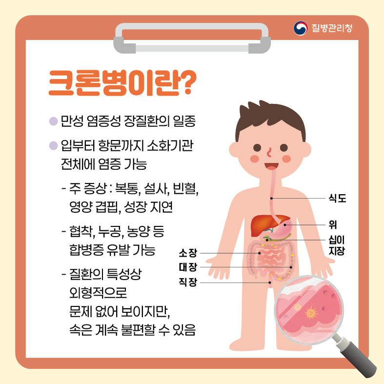 <크론병>
1. 크론병이란?
- 만성 염증성 장질환의 일종
- 입부터 항문까지 소화기관 전체에 염증 가능
 · 주 증상 : 복통, 설사, 빈혈, 영양 겹핍, 성장 지연
 · 협착, 누공, 농양 등
 · 질환의 특성상 외형적으로 문제 없어 보이지만, 속은 계속 불편할 수 있음